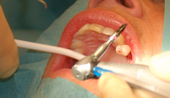 ARTIKEL: Optimism och humor kan hjälpa mot tandvårdsrädslan
